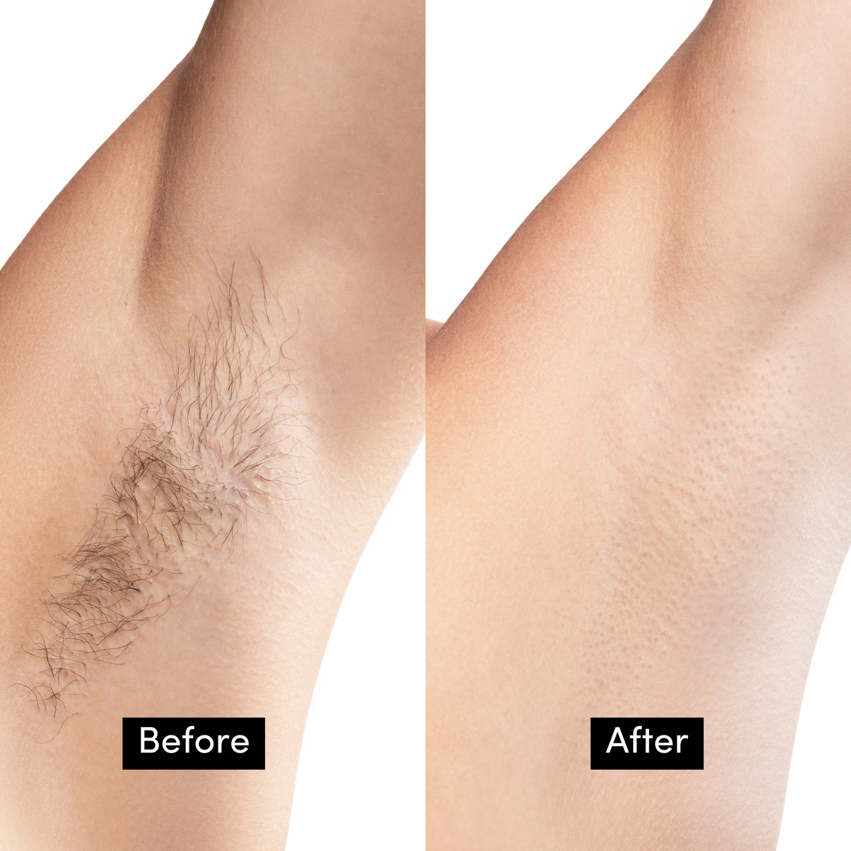 Bikini & Underarm Wax Strips